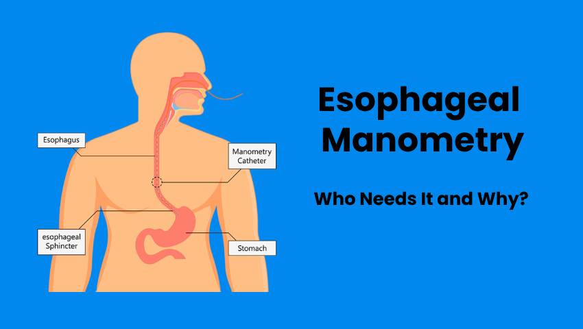 Esophageal Manometry: Who Needs It and Why?