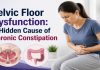 Dr. Rupali Bandgar-Jankar explaining Pelvic Floor Dysfunction and its role in chronic constipation with Biofeedback Therapy